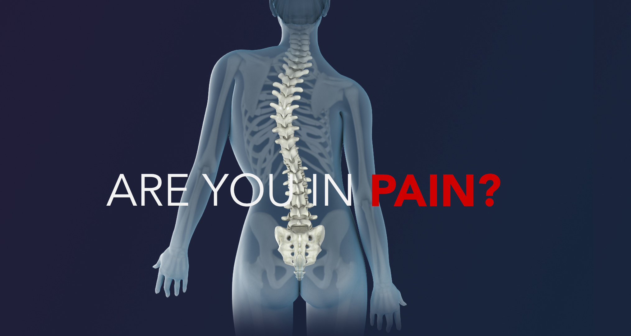 Yoga Scoliosis 4 Class Pack Colour Yoga